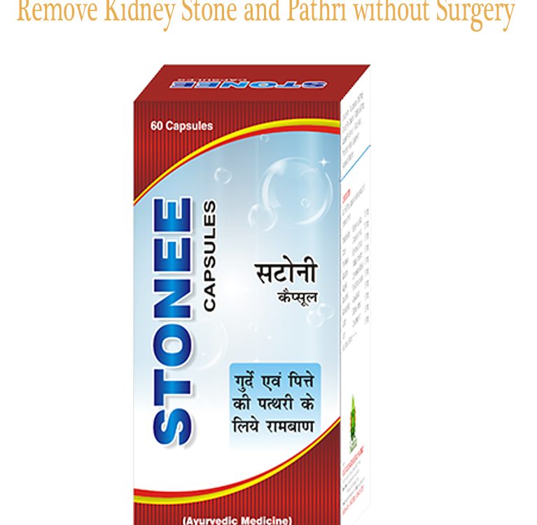 Remove Kidney Stone