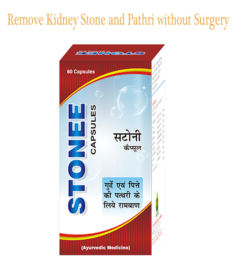 Remove Kidney Stone
